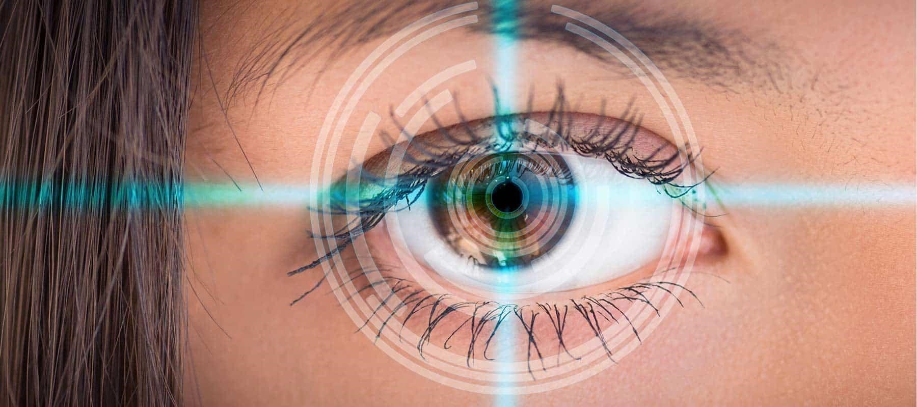 laser myopias
