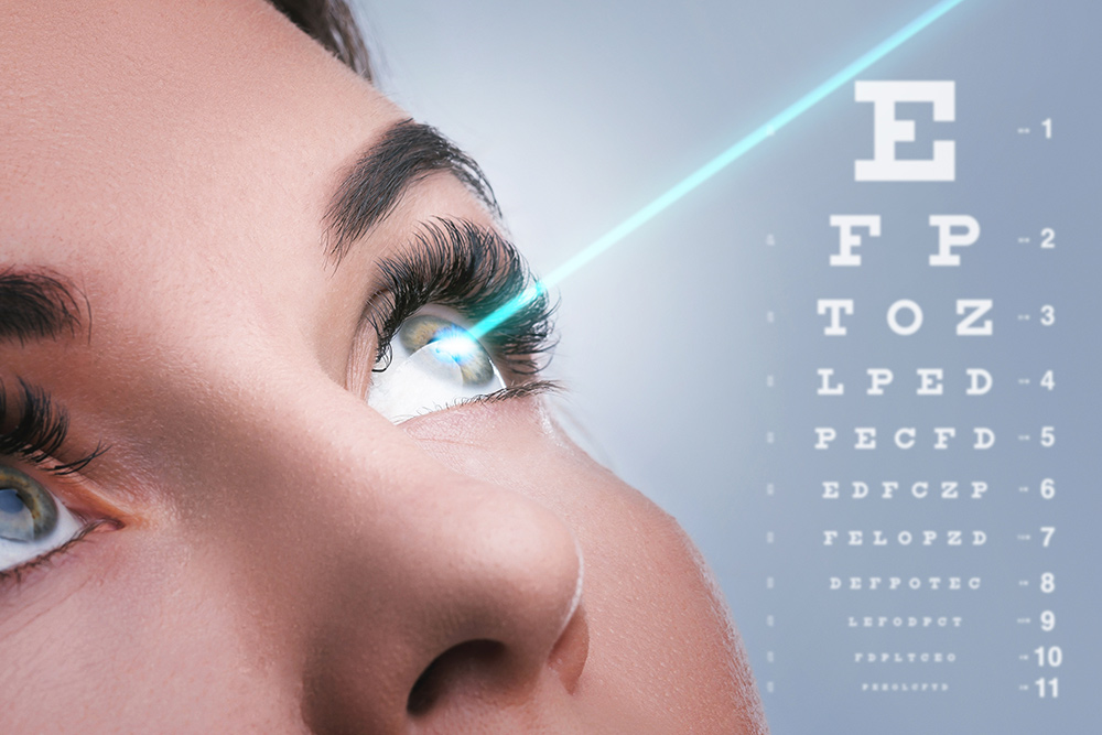 laser myopias 2